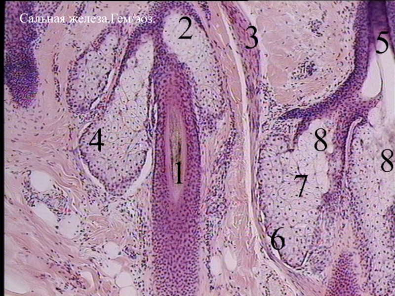 Кожа с волосом. Препарат сальная железа кожи гистология. Стальная железа гистология. Потовые железы кожи гистология. Потовая железа гистология препарат.