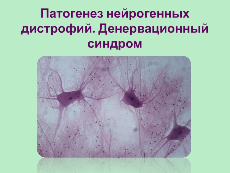 Патогенез нейрогенных дистрофий. Денервационный синдром
