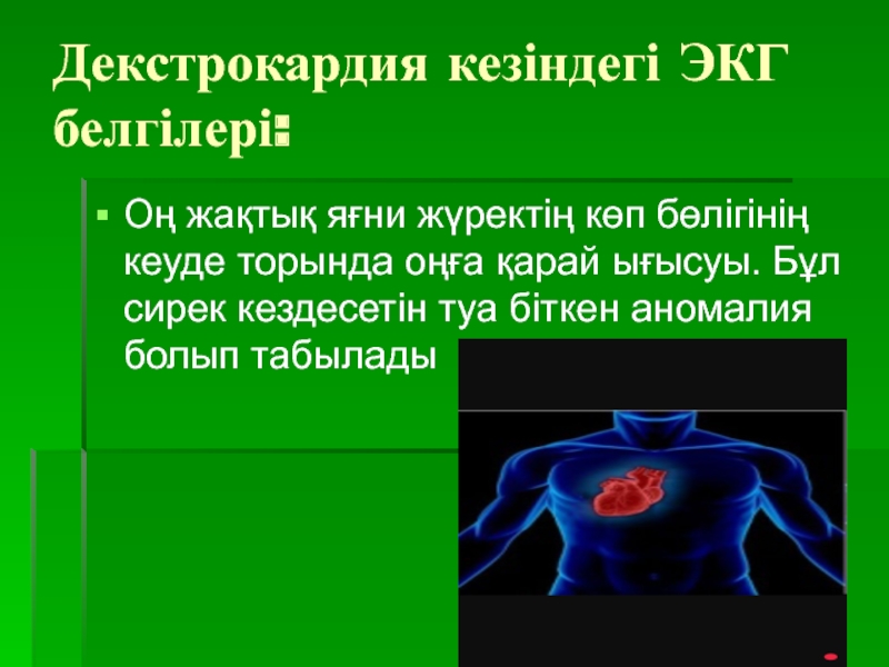 Декстрокардия. Истинная и ложная декстрокардия. Декстрокардия на ЭКГ.