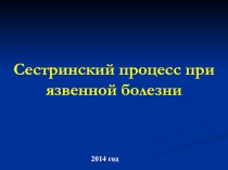 Сестринский процесс при язвенной болезни