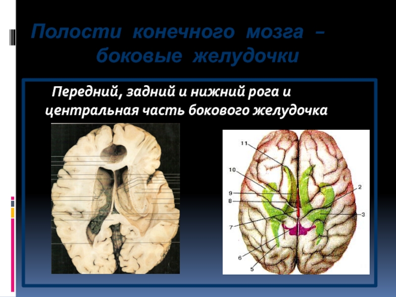 Боковые рога мозга. Боковые желудочки конечного мозга. Нижний Рог бокового желудочка. Нижний Рог бокового желудочка ограничен. Боковые желудочки конечного мозга функции.