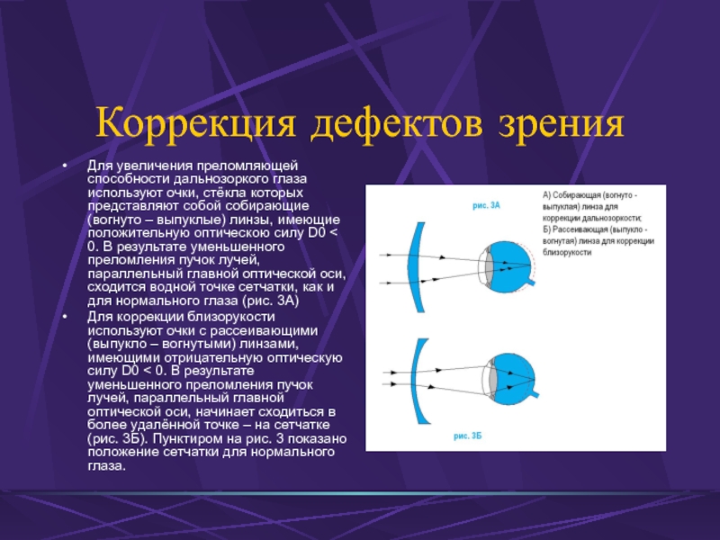 Дефекты зрения физика презентация