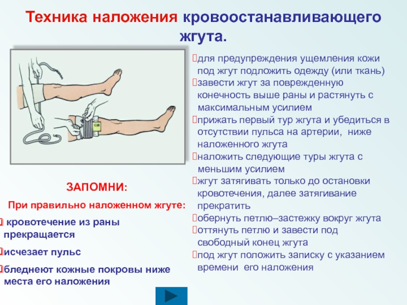 Выше раны. При наложении кровоостанавливающего жгута нельзя …. Техника наложения кровоостанавливающего жгута. Наложение кровоостанавливающего жгута алгоритм. Тур при наложении жгута.