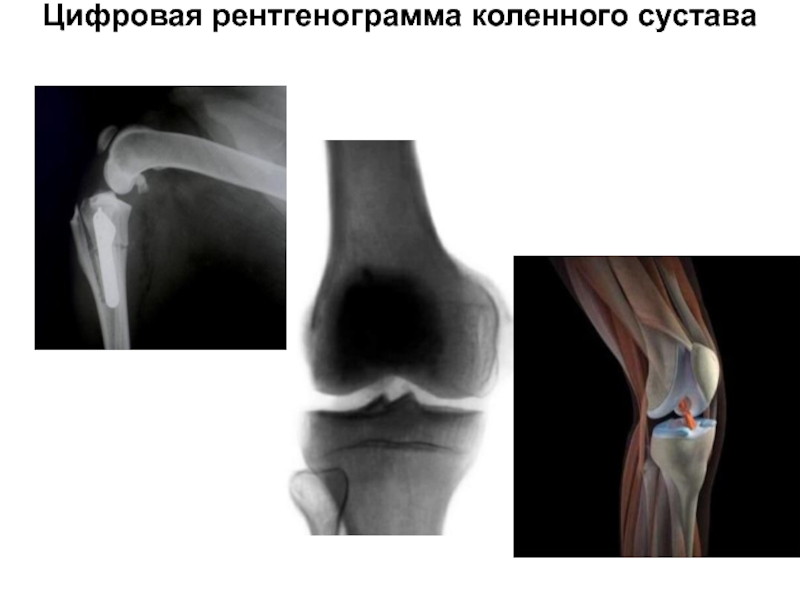 Реферат: Цифровая рентгенография