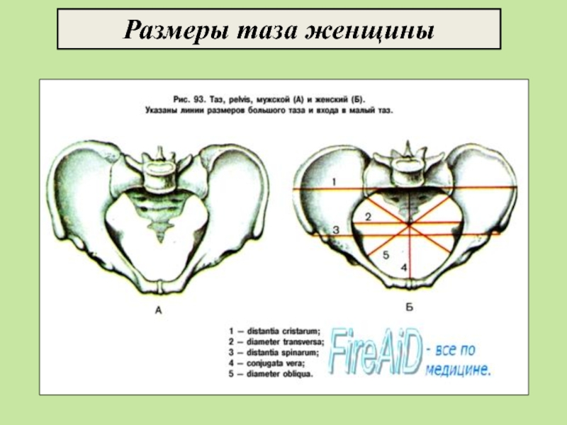 Акушерские размеры таза на рисунке