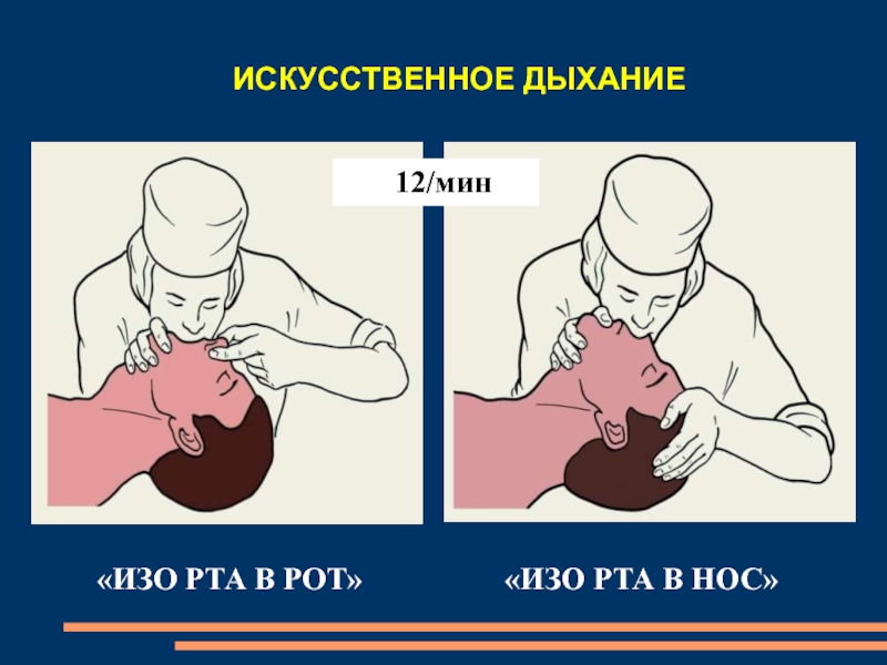 Искусственное дыхание картинки для презентации