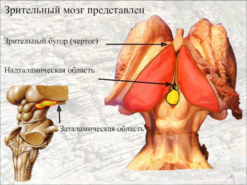 Зрительный мозг. Зрительный бугор. Левый зрительный бугор. Надталамическая область. Таламус надталамическая область.