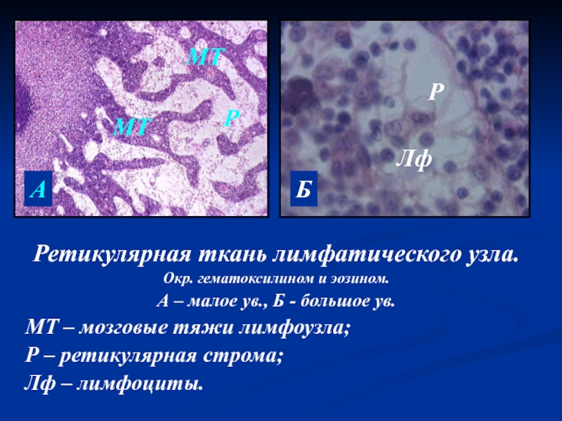 Ретикулярная ткань. Ретикулярная ткань лимфатического узла окраска гематоксилин эозин. Лимфоузел ретикулярная ткань. Ретикулярная ткань лимфатического узла. Ретикулярная ткань лимфатического узла строение.