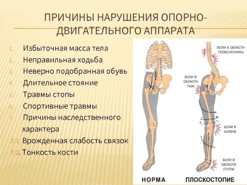 Нарушения опорно двигательного аппарата презентация