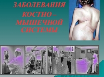 Заболевания костно-мышечной системы