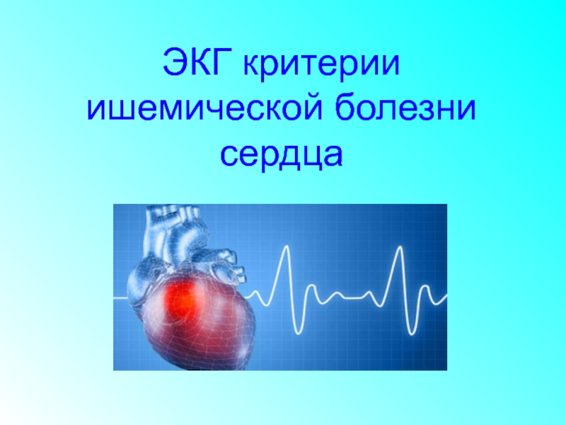 ЭКГ критерии ишемической болезни сердца
