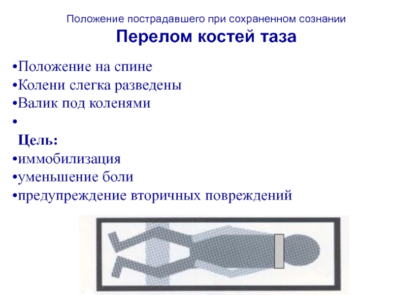 Положение 8. Цели транспортной иммобилизации уменьшить болевые. Цели транспортной иммобилизации уменьшить болевые ощущения допиши. Чугунный сустав цель. Фраза про перелом сознания.