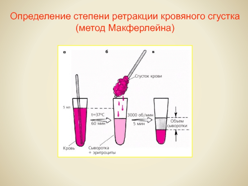 32 измерения. Ретракция кровяного сгустка. Ретркакия кровного скгутска. Ретракция кровяного сгустка анализ. Ретракция кровяного сгустка исследование.