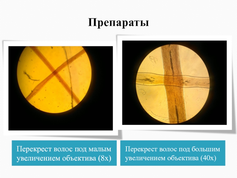 Малое увеличение. Перекрест волос под микроскопом. Перекрест волос под микроскопом х4. Перекрест волос под микроскопо. Перекрест волос под микроскопом большое увеличение.