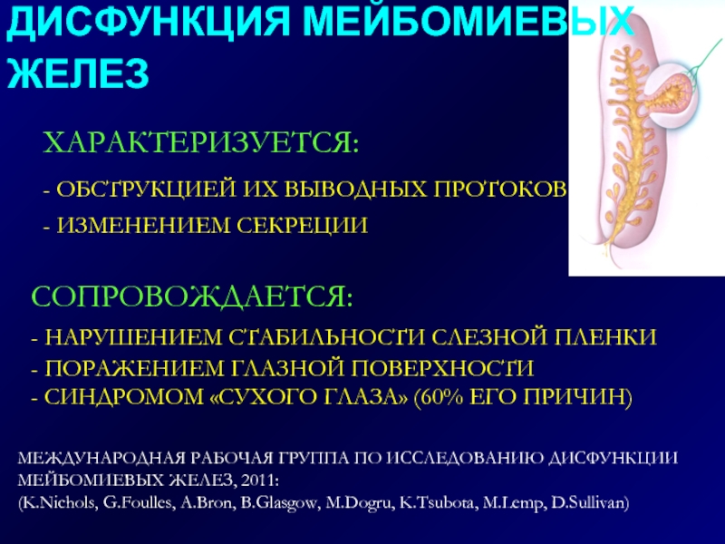 Нарушение работы желез. Дисфункция мейбомиевых желез глаза. Закупоренные протоки мейбомиевых желез. Закупорка мейбомиевой железы. Гиперсекреция мейбомиевых желез.