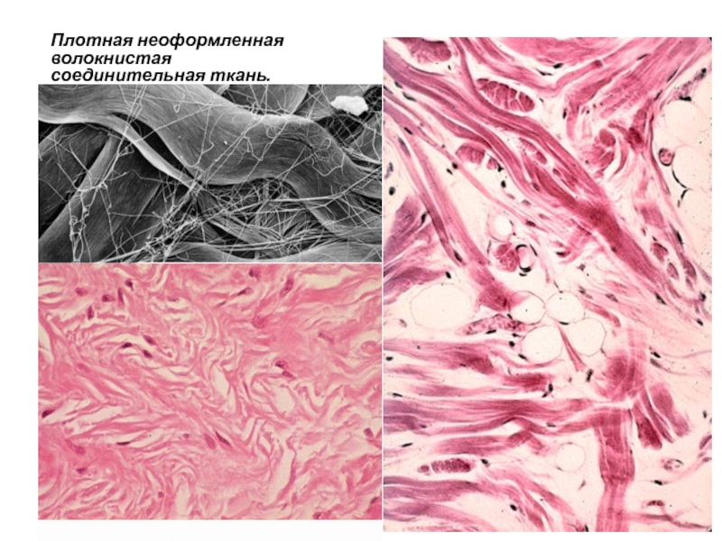 По изображению с микроскопа в препарате кожи пальца в плотной соединительной ткани