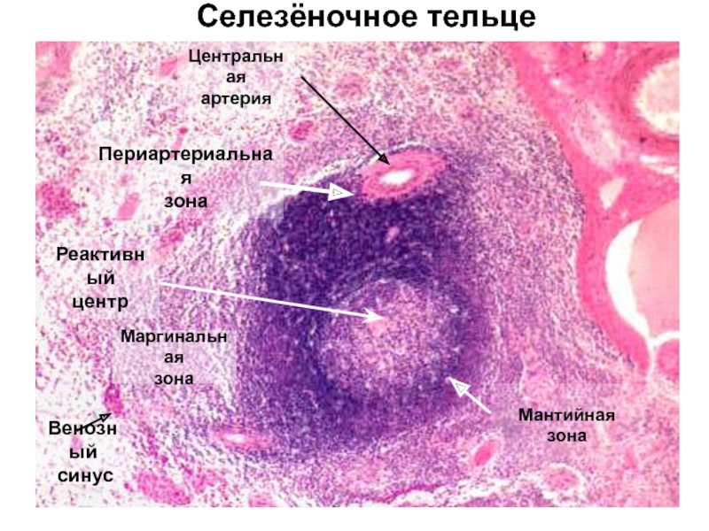 Селезенка гистология рисунок с подписями