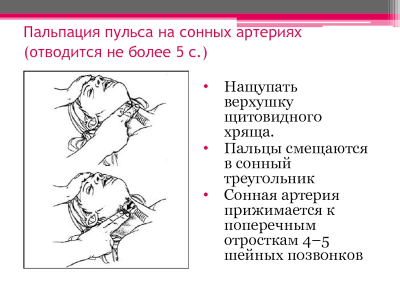 Сонная пульс пульс сонная. Определение пульса на сонной артерии алгоритм. Измерение пульса на сонной артерии алгоритм. Пальпация пульса на сонных артериях. Артерии для пальпации пульса.