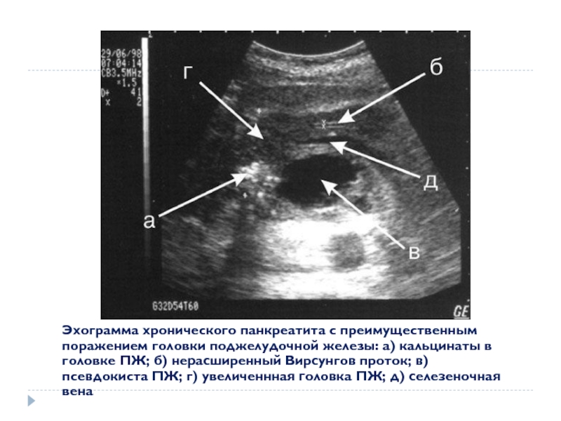 План обследования при хроническом панкреатите