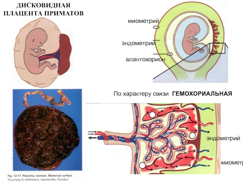 Плацента акушерство презентация