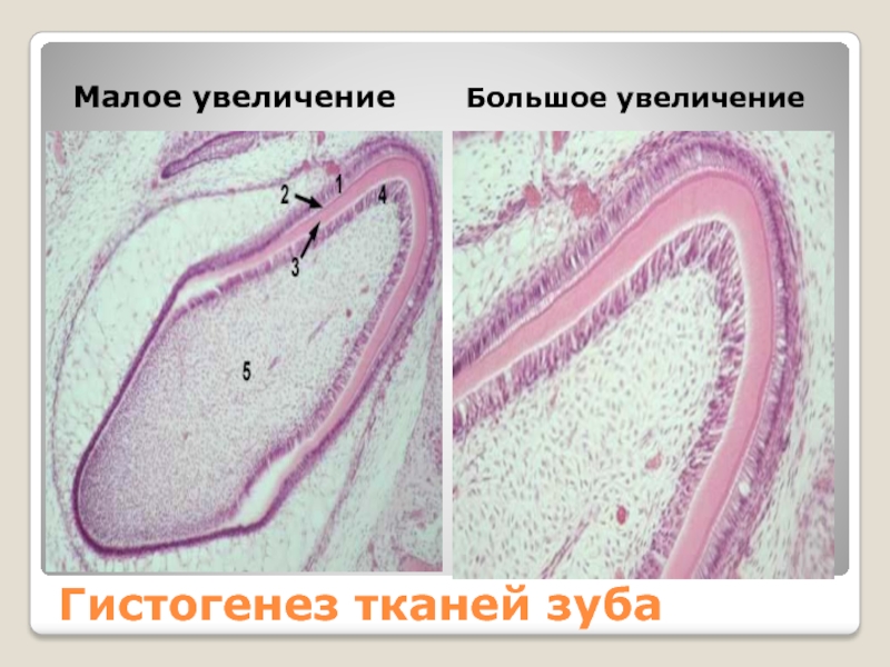 Малое увеличение. Гистогенез зубных тканей. Гистогенез гистология.