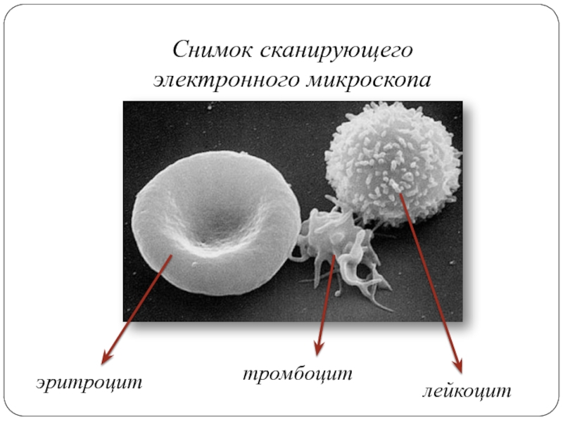 Фотографии сканирующего электронного микроскопа