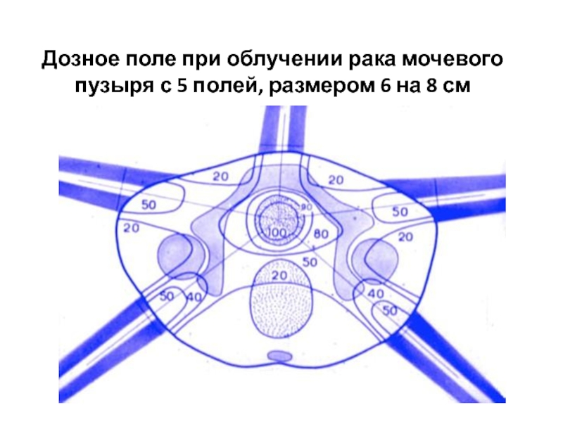 Облучение при полете на самолете