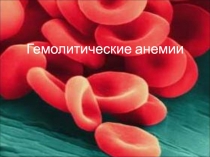 Гемолитические анемии 