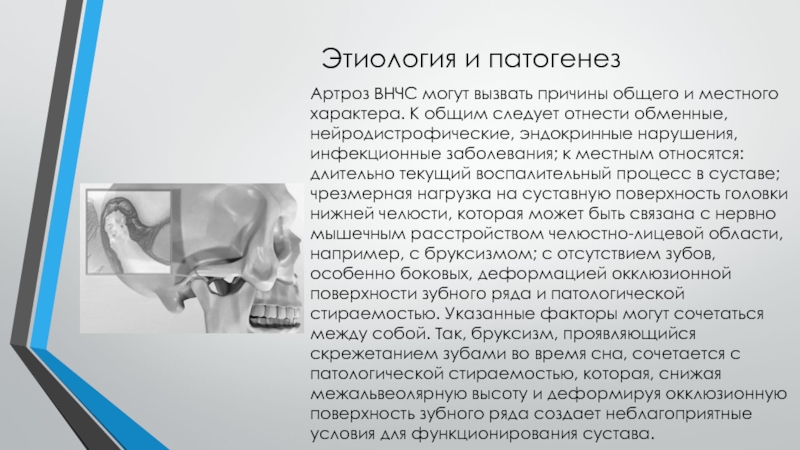 Лечение челюстного артрита. Деформирующий остеоартроз ВНЧС клиника. Височно-нижнечелюстной артрит патогенез.