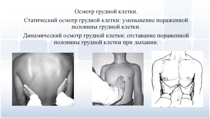 Половина дыхания. Статический и динамический осмотр грудной клетки. Участие обеих половин грудной клетки в акте дыхания. Отставание грудной клетки при дыхании. Осмотр грудной клетки.