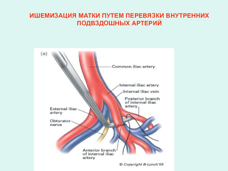 Зачем артерия