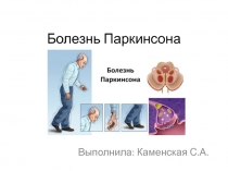 Болезнь Паркинсона
