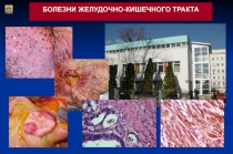 Болезни желудочно-кишечного тракта 