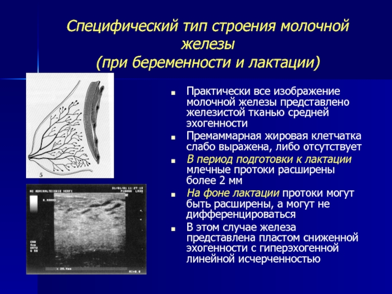 Тип строения d. Тип структуры молочных желез. Тип строения молочных желез УЗИ при беременности. Структура молочной железы железистая ткань. Ювенильное строение молочной железы.