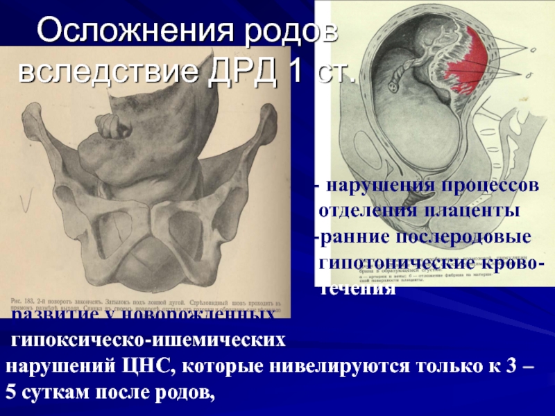 Периоды родов осложнения. Осложнения аномалий родовой деятельности. Осложнения при аномалиях родовой деятельности. Осложнения в родах при аномалиях родовой деятельности:.