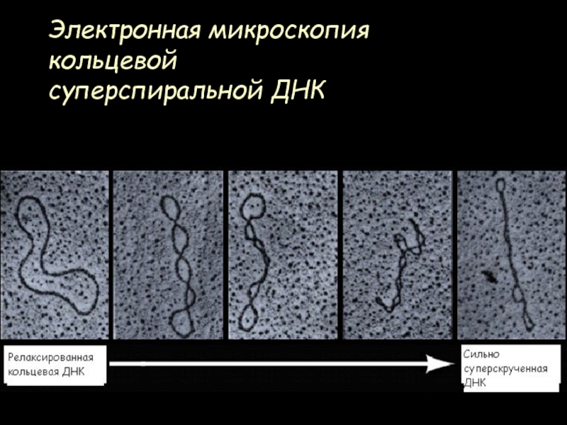 Электронная микроскопия  кольцевой  суперспиральной ДНК
