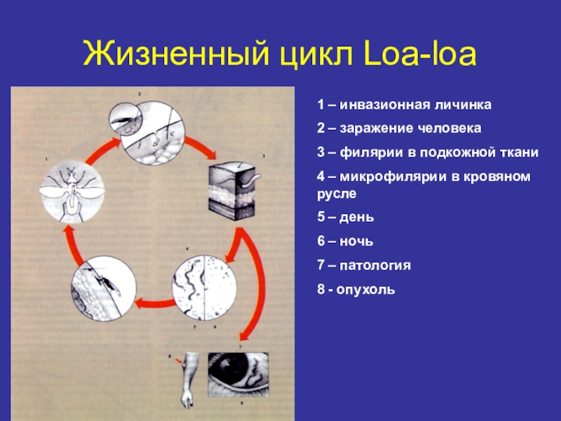 Распространенность гименолепидоза на территории России Жизненный цикл Loa-loa1 – инвазионная личинка2 – заражение человека3 – филярии Жизненный цикл Loa-loa1 – инвазионная личинка2 – заражение человека3 – филярии в подкожной ткани4 – микрофилярии в
