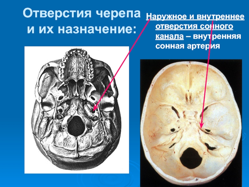 Основание черепа где. Внутреннее основание черепа анатомия. Кости основания черепа анатомия. Внутренняя Сонная артерия на основании черепа. Шилососцевидное отверстие на основании черепа.