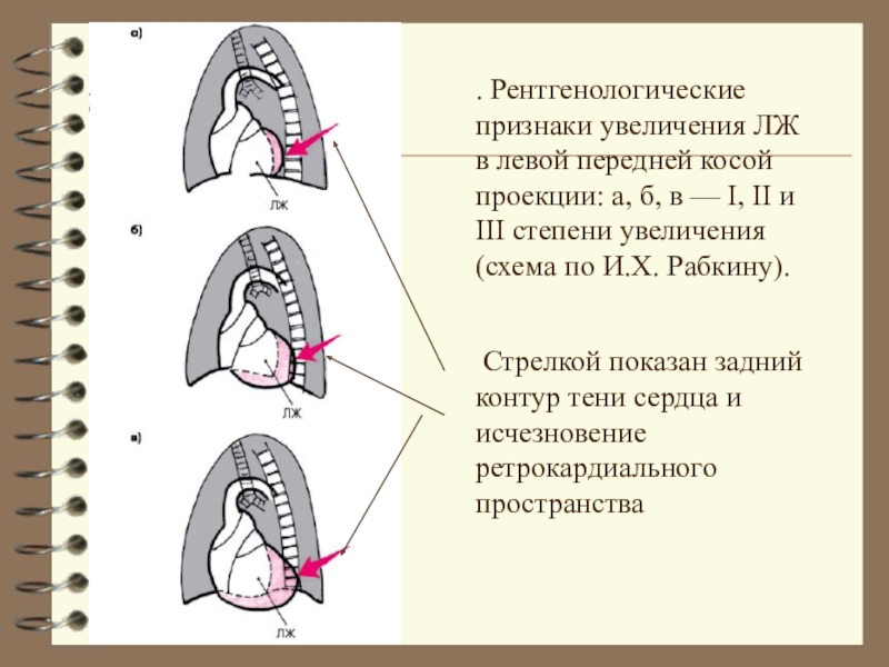 Косая проекция. Косая проекция в рентгенологии. Контур сердца в косых проекциях. Контуры сердца в косой проекции. Вторая косая проекция.