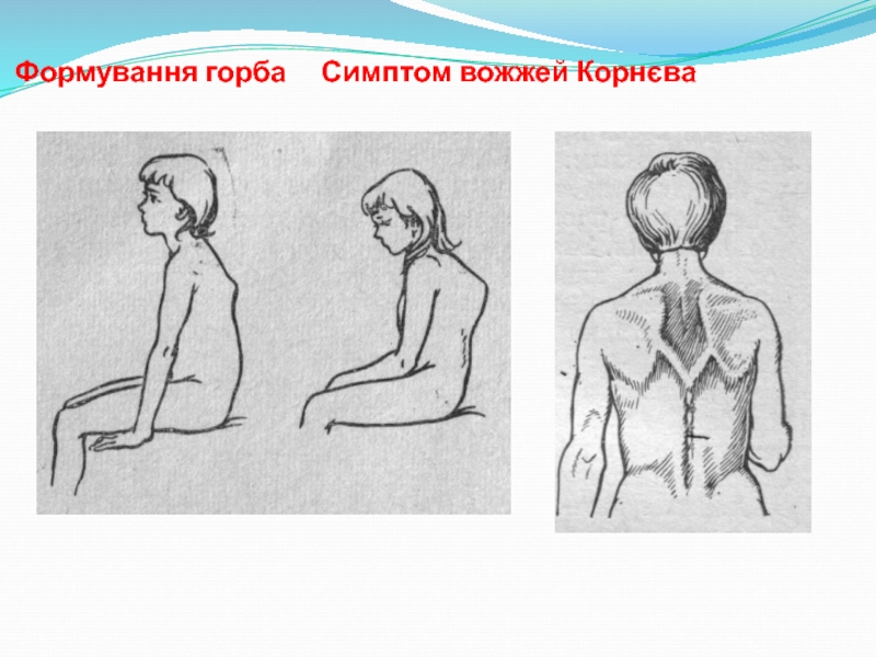 Как называется горб