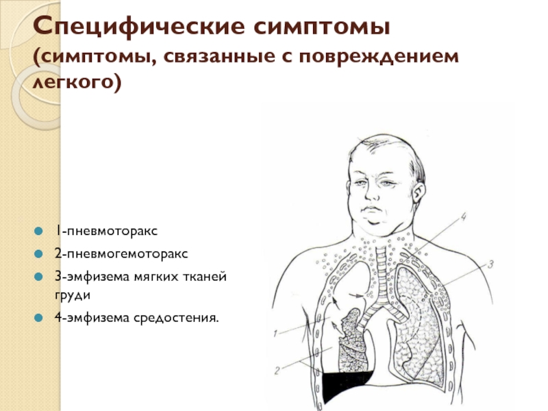 Ушиб грудной клетки карта. Эмфизема средостения симптомы. Эмфизема средостения и шеи. Эмфизема при травме грудной клетки. Эмфизема мягких тканей при пневмотораксе.