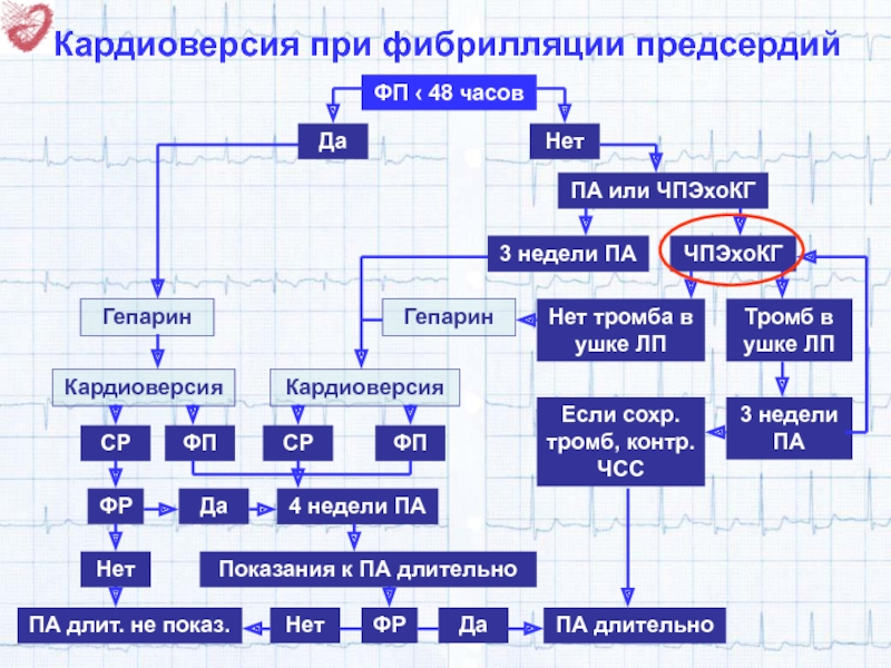 Электрическая кардиоверсия при фибрилляции предсердий. Кардиоверсия при фибрилляции. Фибрилляция предсердий кардиоверсия. Электрическая кардиоверсия при фибрилляции предсердий показания.