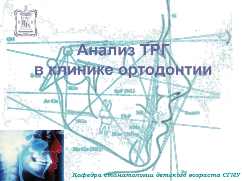 Презентация Анализ ТРГ в клинике ортодонтии