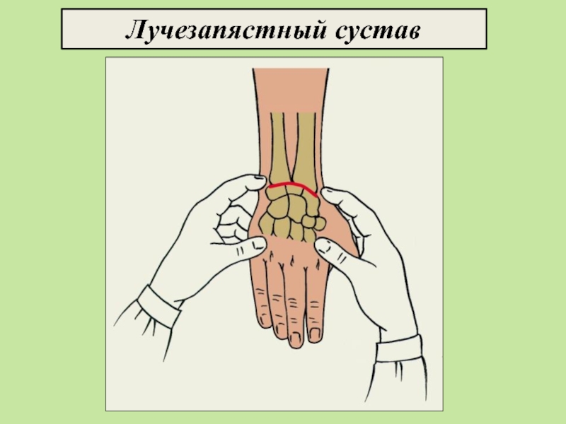 Реабилитация после перелома лучевой кости запястья