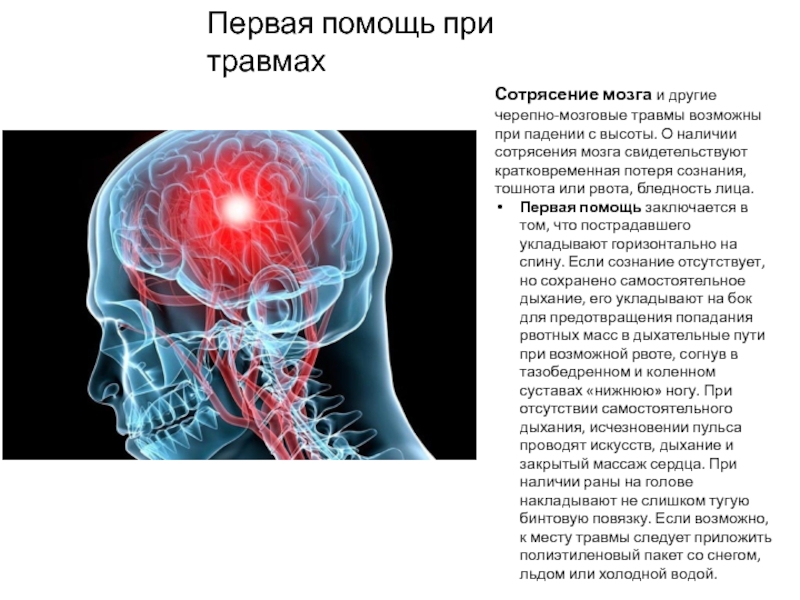 Сотрясение головного мозга презентация