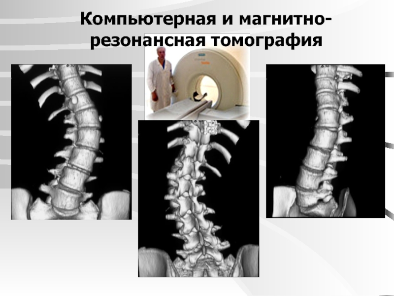 Проект по теме сколиоз