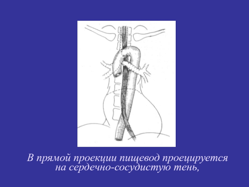 Лучевая диагностика пищевода презентация