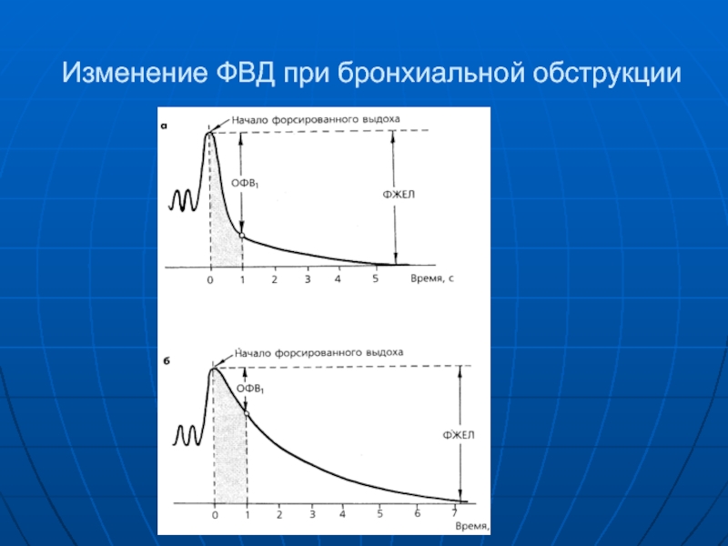 Фвд дыхание. Исследование функции внешнего дыхания при бронхиальной астме. Заключение ФВД при бронхиальной астме. График ФВД при бронхиальной астме. Показатели функции внешнего дыхания при бронхиальной астме.