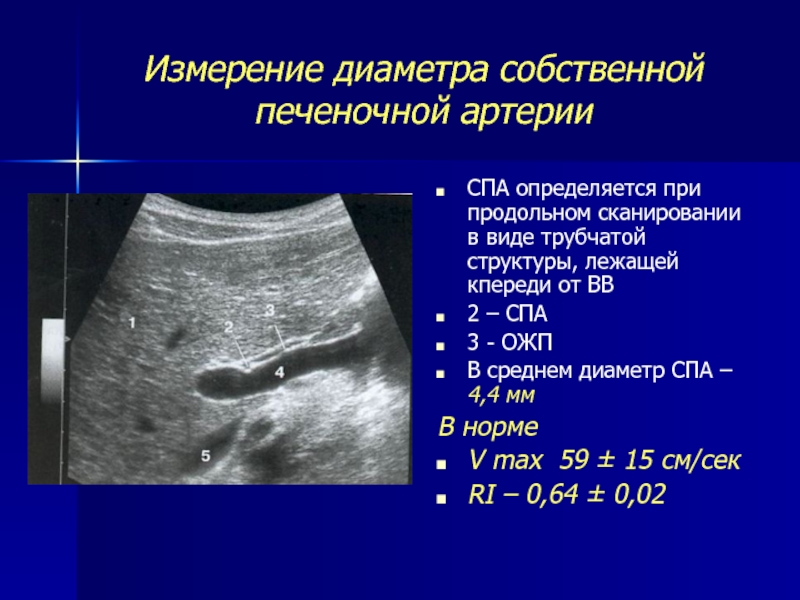 Измерение печени на узи схема