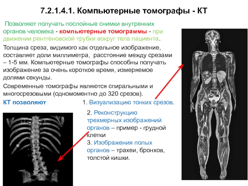 Получить послойное изображение органа позволяет